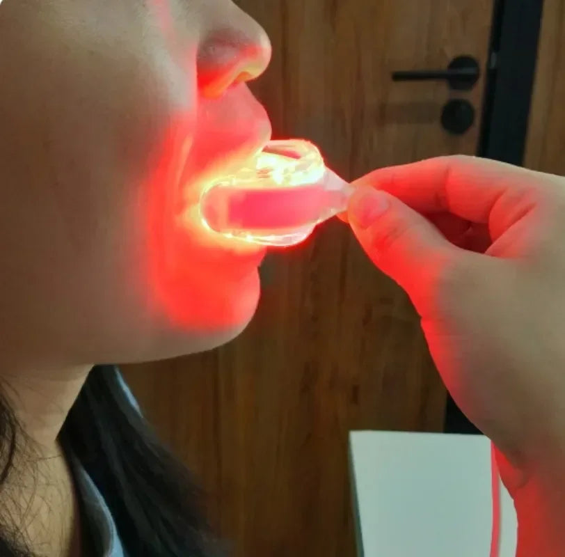 Oral alternative therapy- laser treatment for Bacteria counts